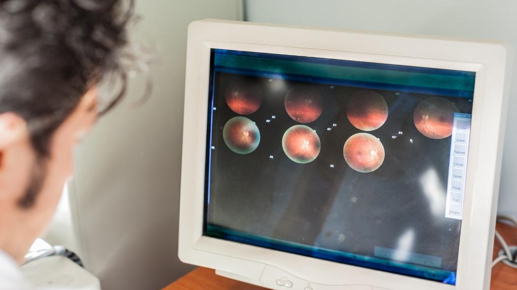 Oftalmólogo analizando un escáner de retina - Hospital Sant Joan de Déu Barcelona