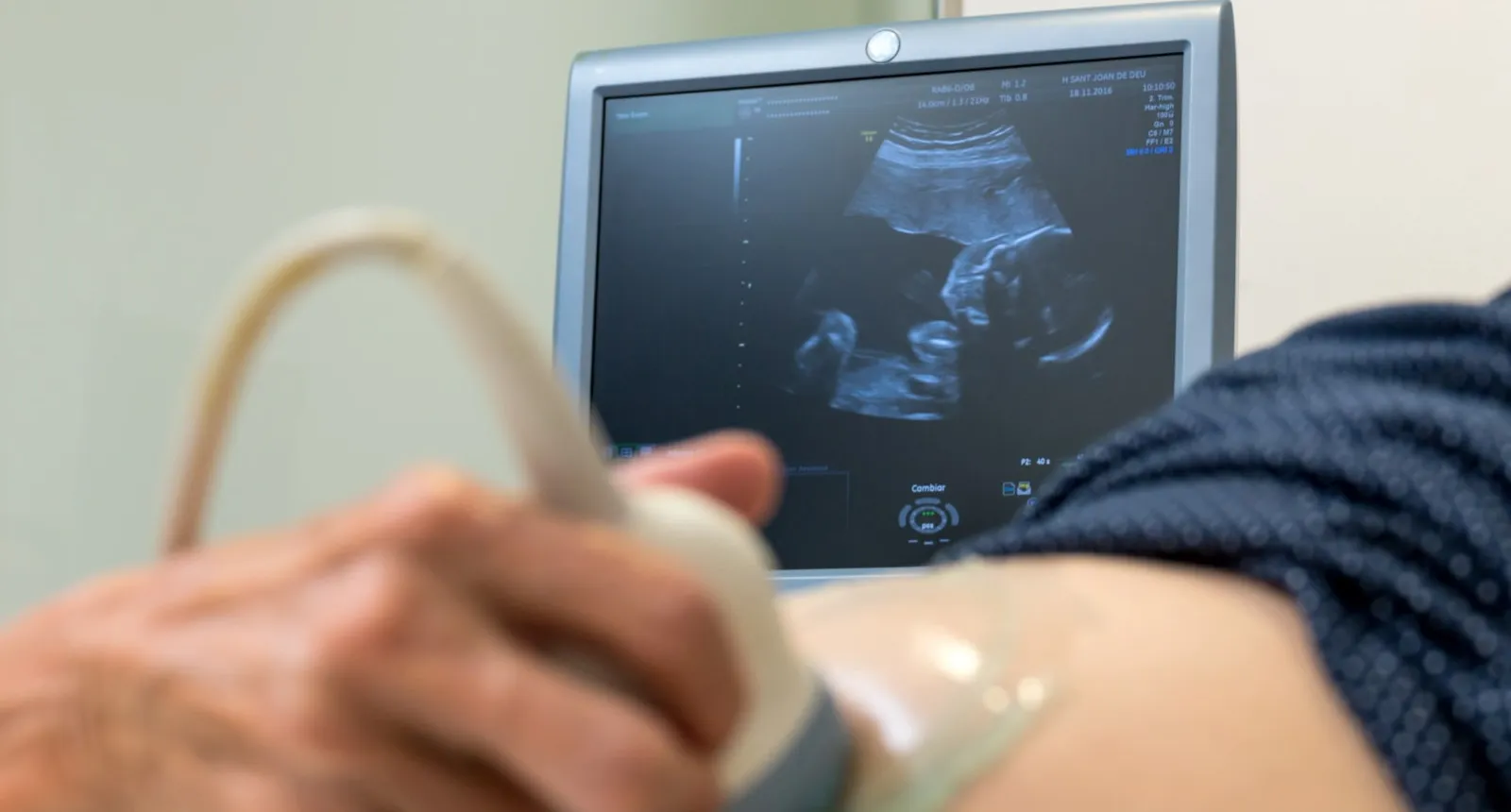 Ecografía embarazo