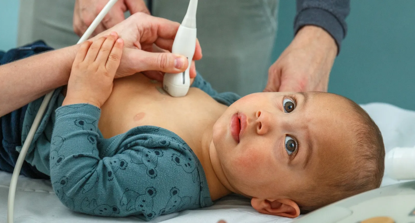 Cardiac ultrasound on a baby - SJD Barcelona Children's Hospital