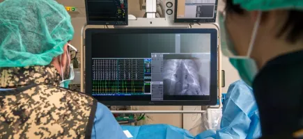 Equipo de profesionales durante una cardiocirugía en un niño en el Hospital Sant Joan de Déu Barcelona