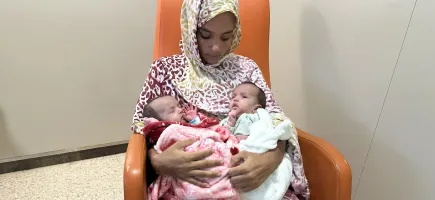 Hermanas siamesas separadas con éxito en el Hospital Sant Joan de Déu Hermanas siamesas separadas en Sant Joan de Déu