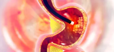 Máster en Gastroenterología, Hepatología y Nutrición Pediátrica Máster en Gastroenterología, Hepatología y Nutrición Pediátrica