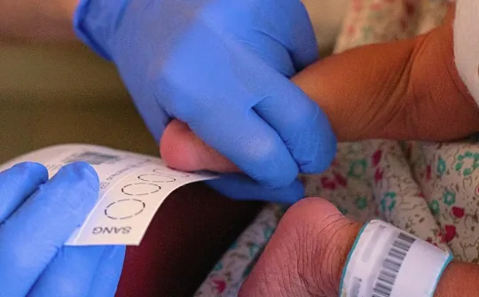 Heel prick test on a baby at the SJD Barcelona Children's Hospital Heel prick test on a baby at the SJD Barcelona Children's Hospital